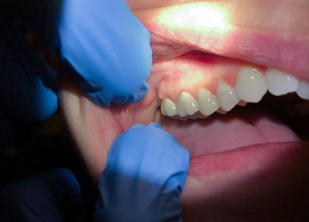 Best Emergency Cosmetic Dentistry in Newark, NJ